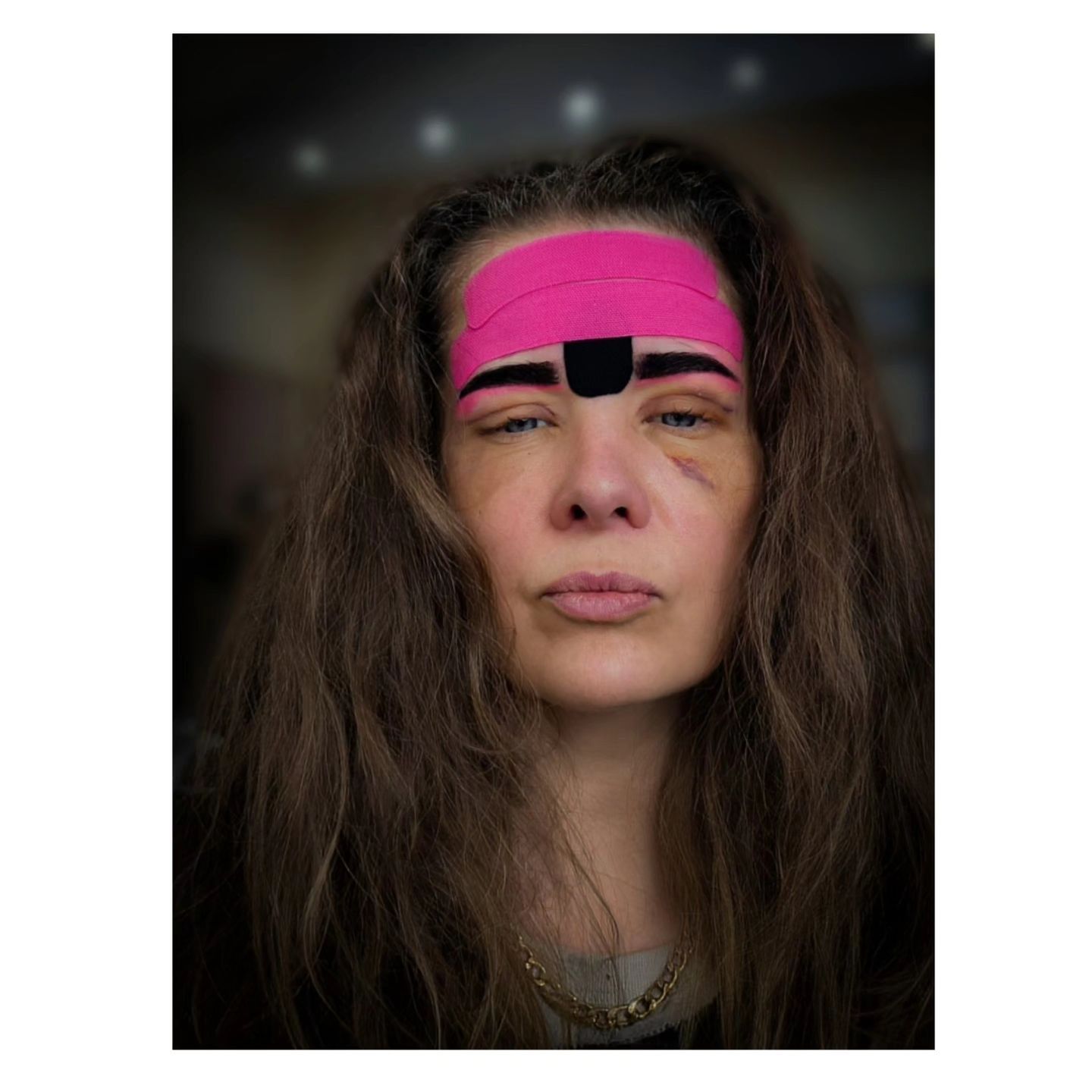 Anna Powierza po zabiegach