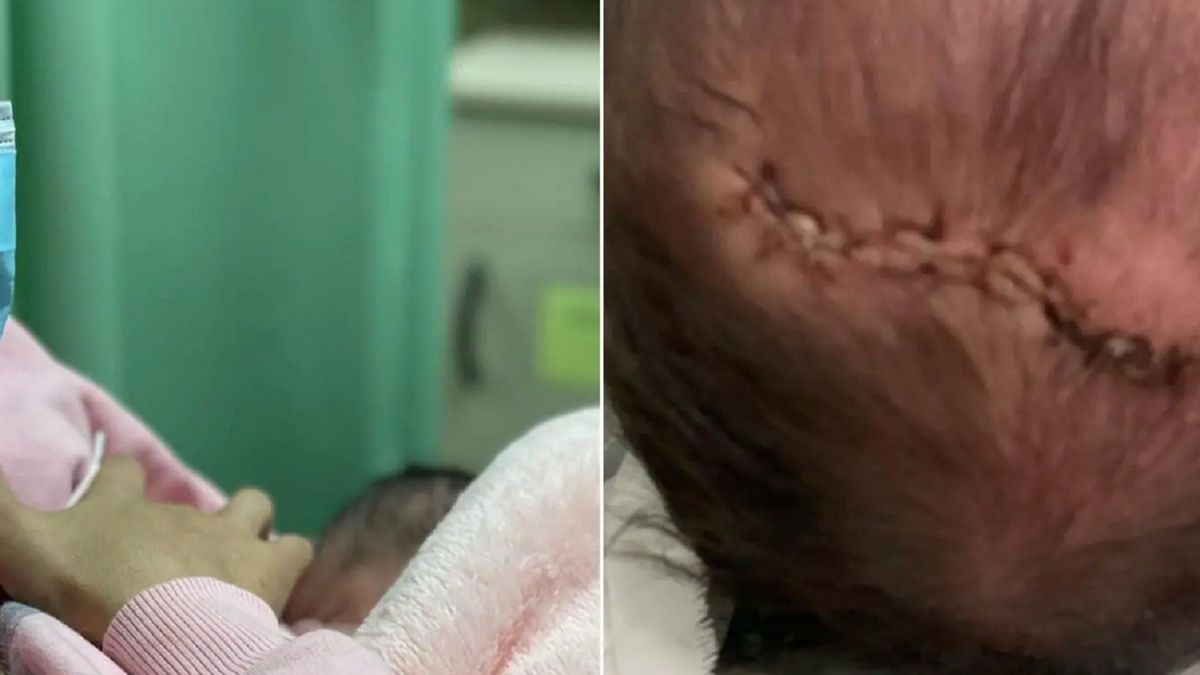 Dziecko miało 11 szwów.