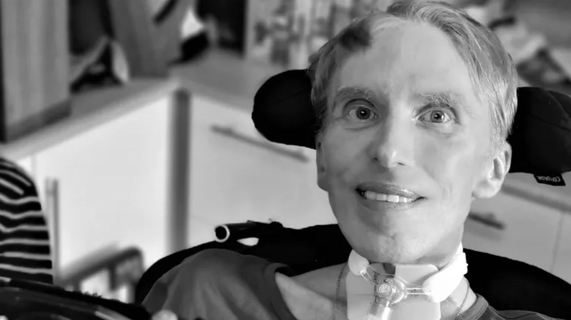 Nie żyje dr Peter Scott-Morgan. Pierwszy cyborg w historii