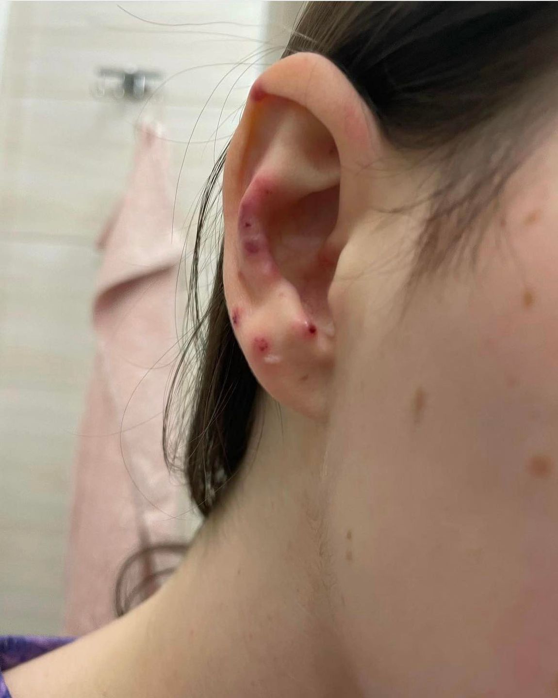 Wiktoria Cwynar zapadła na tajemniczą chorobą