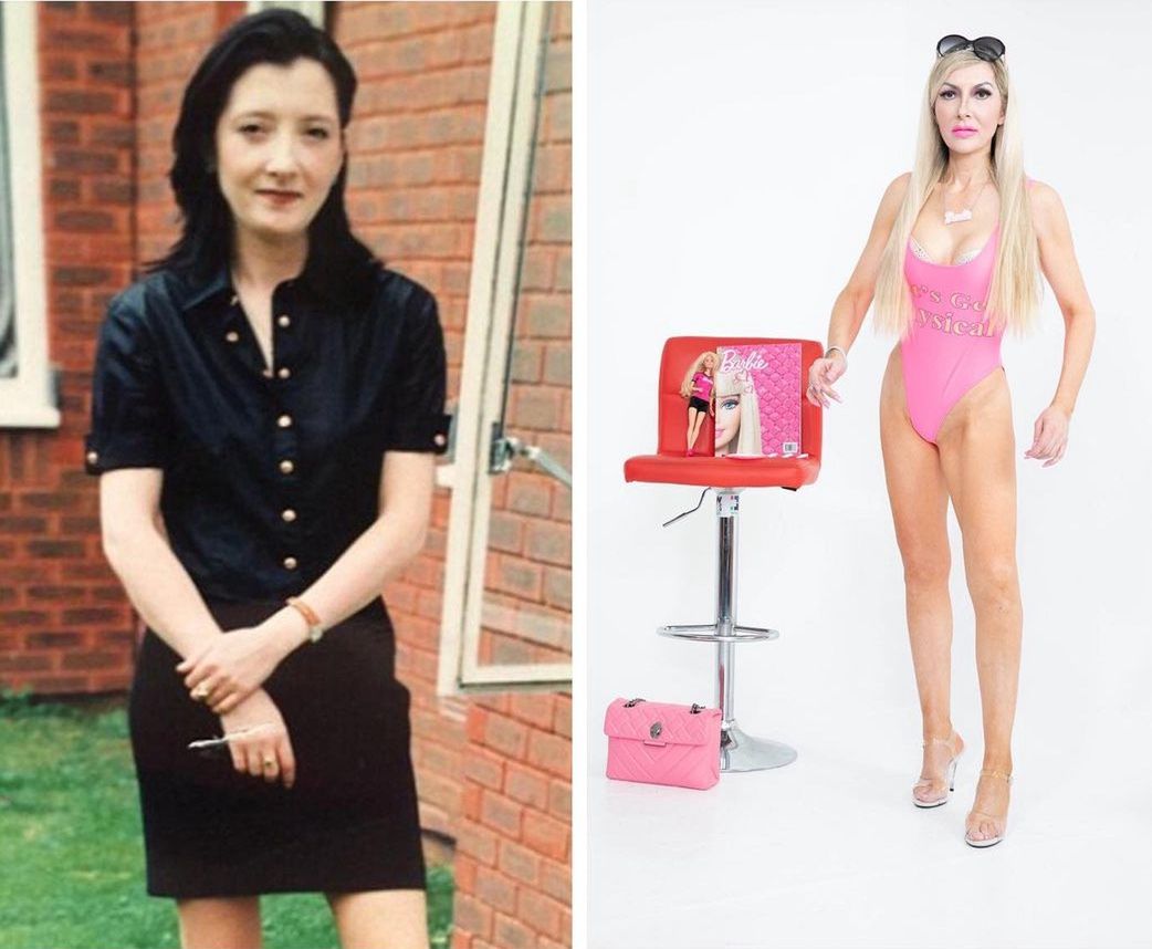 Metamorfoza w "żywą Barbie" (Rachel w wieku 20 i 40 lat)