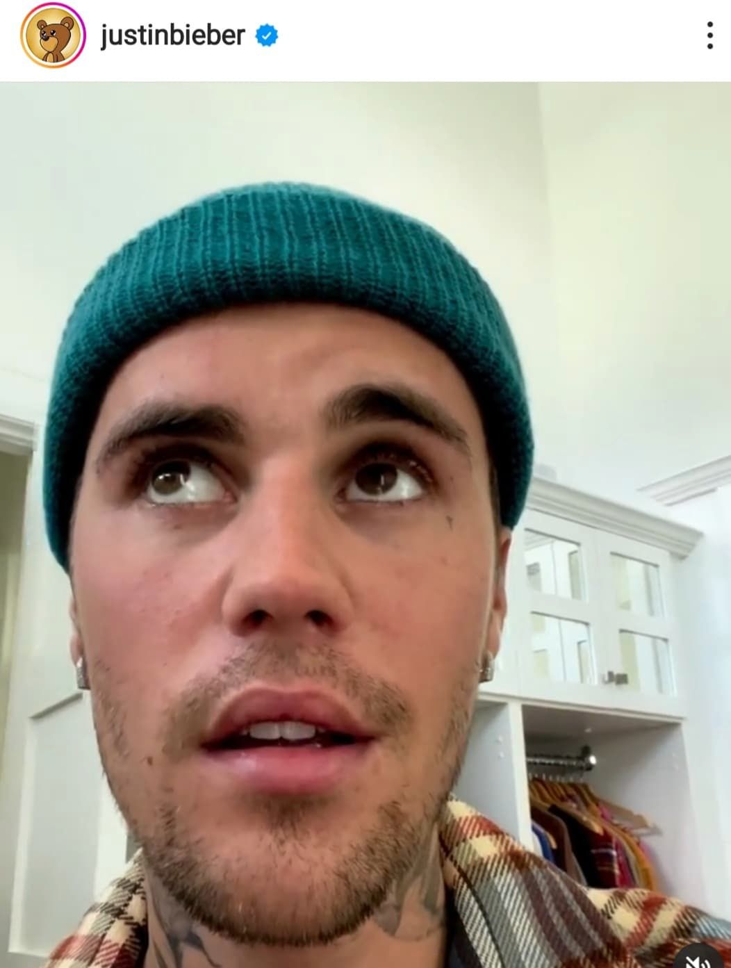 Justin Bieber ma sparaliżowaną twarz