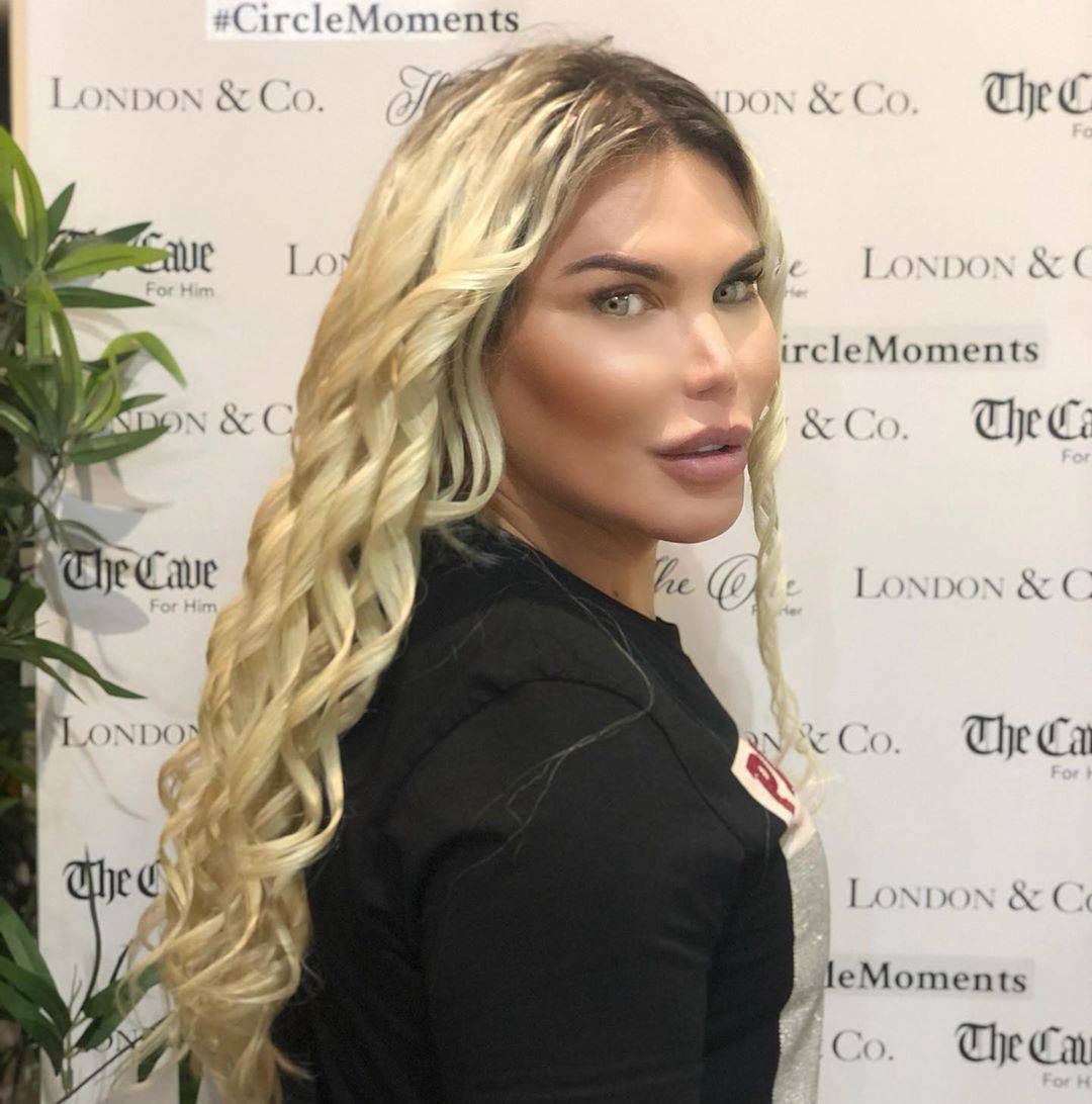 Rodrigo Alves po zmianie płci