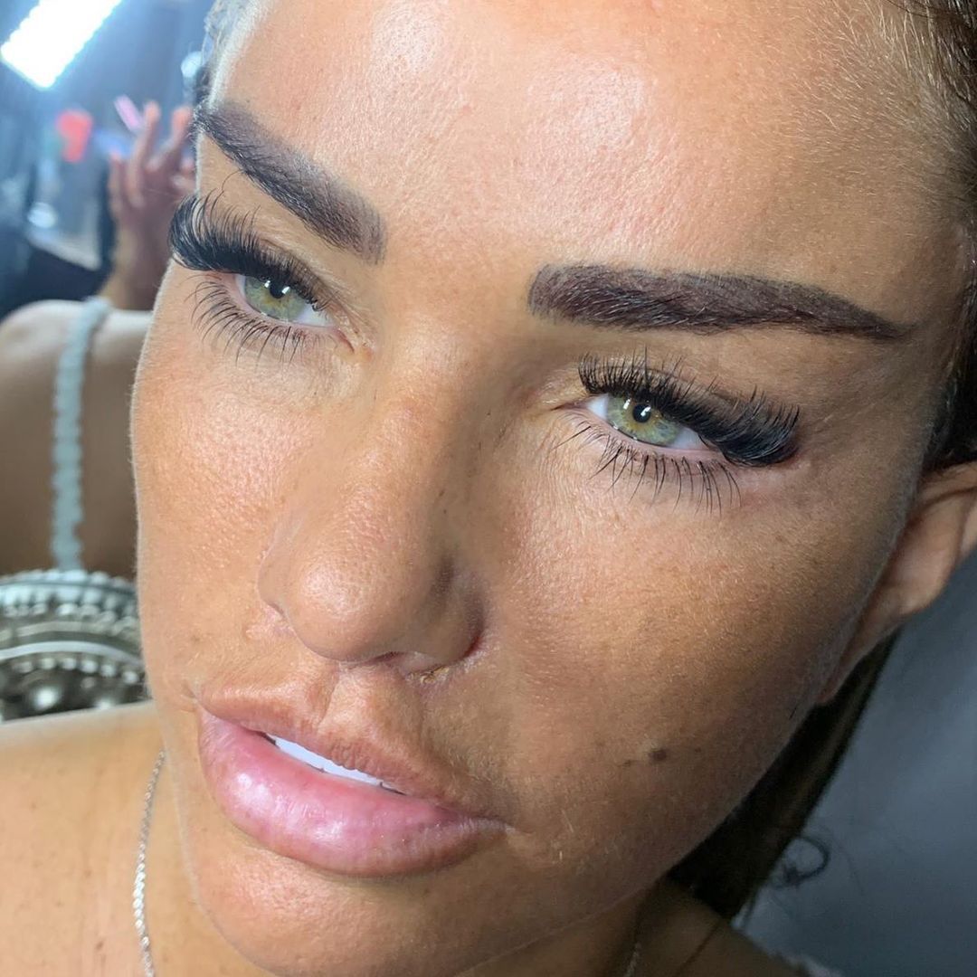 Katie Price pokazała twarz po operacjach plastycznych