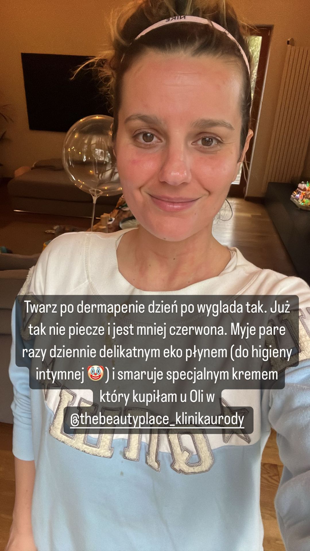 Zosia Zborowska pokazała twarz po zabiegu