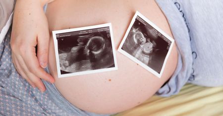 Mieszkanka Opola po raz trzeci została mamą bliźniąt