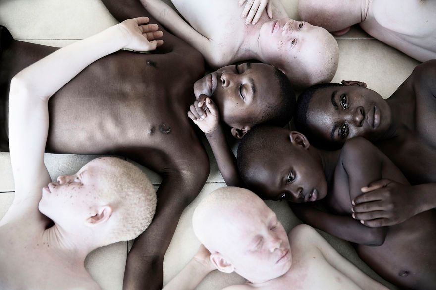Wyjątkowe zdjęcia albinosów pomagają zwrócić uwagę na ich trudną sytuację w Tanzanii 6