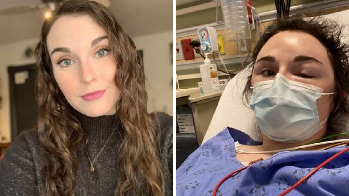 23-latka z ciężką reakcją alergiczną. Apeluje do fryzjerów o większą ostrożność