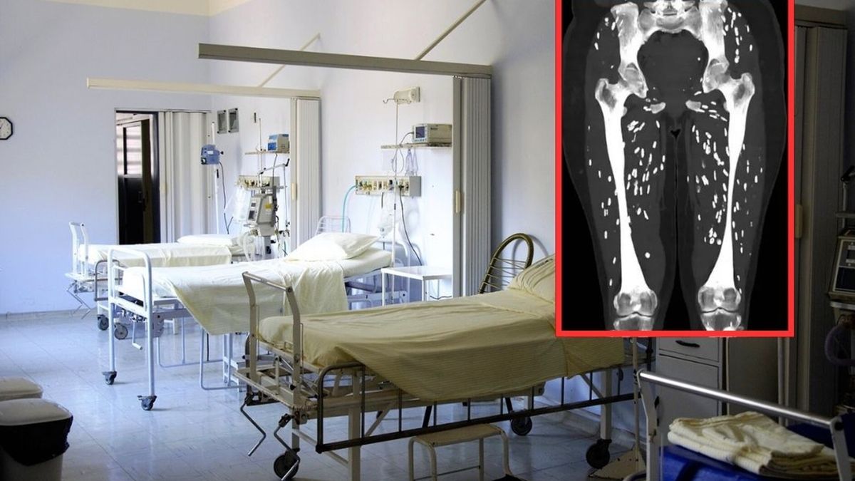 Pokazał zdjęcie rentgenowskie pacjenta. Mrozi krew w żyłach