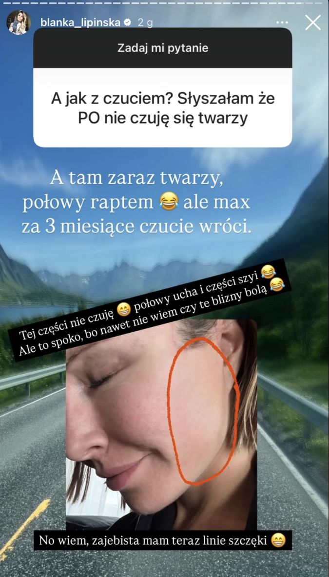 Blanka Lipińska pokazała blizny po liftingu 