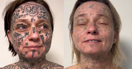 Partner oszpecił jej ciało. Usunęła 250 tatuaży ze skóry