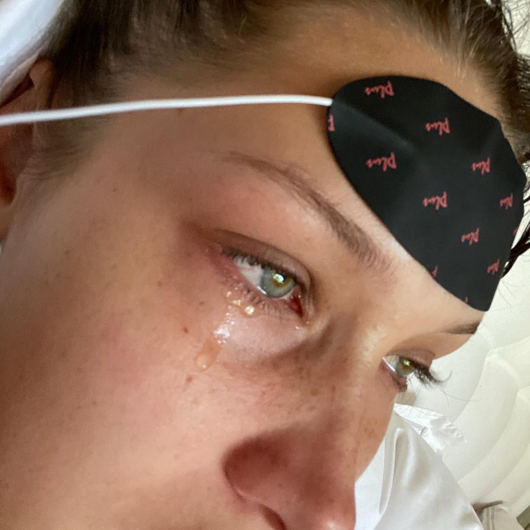 Bella Hadid o zdrowiu psychicznym
