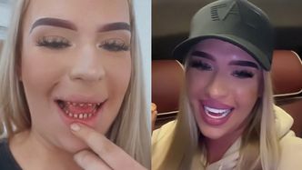 Polka wydała małą fortunę na "tureckie zęby". Pochwaliła się metamorfozą. Było warto? (WIDEO)