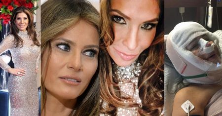 Ta kobieta wydała 50 tysięcy dolarów, by wyglądać jak... Melania Trump! Opłaciło się? (ZDJĘCIA)