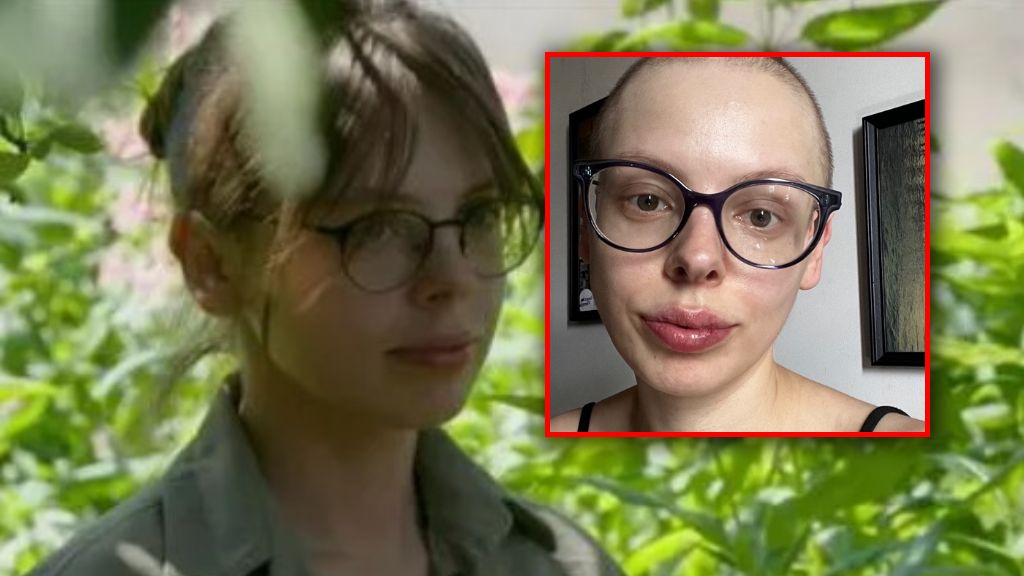 Marcelina Szwarga Kapcia ma nowotwór