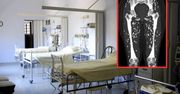 Pokazał zdjęcie rentgenowskie zakażonego pacjenta. Widok budzi niepokój