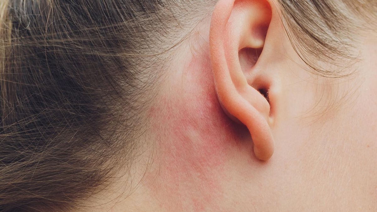 Wszelkie dolegliwości należy konsultować ze specjalistą, ponieważ mogą to być pierwsze objawy raka