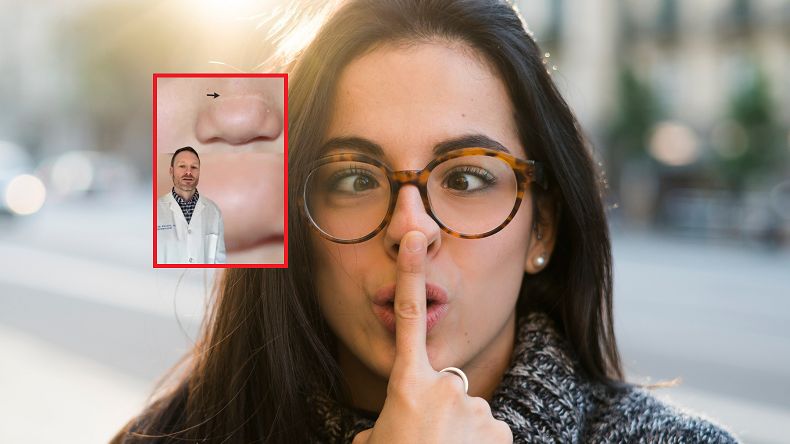 Masz widoczną linię na nosie? Przyczyną może być powszechny w dzieciństwie nawyk