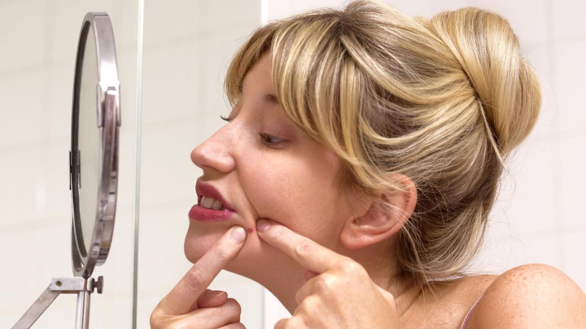  Z trądzikiem można walczyć na wiele sposobów