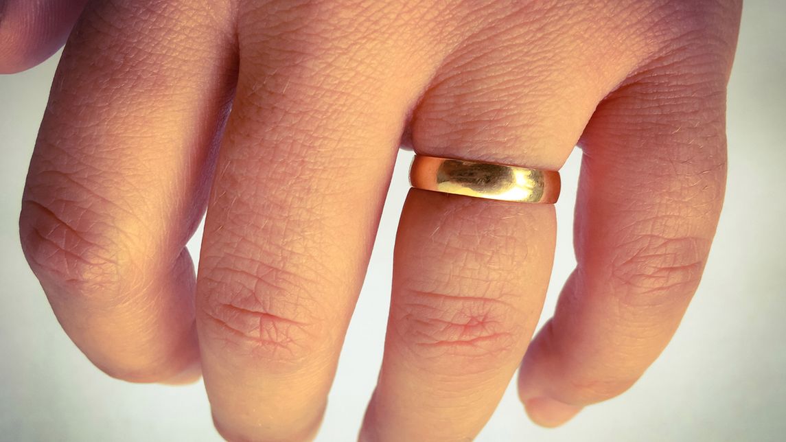 Spuchnięte dłonie mogą być objawem choroby (iStock)