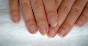 Trik na suche i zniszczone paznokcie. Wystarczy kilka minut