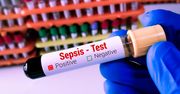 Sepsa zabija w kilka godzin. Ekspert: Liczy się każda minuta i godzina