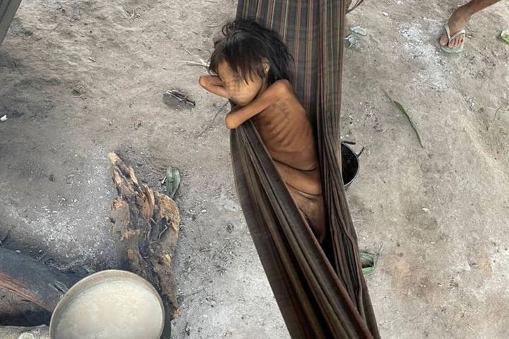 8 lat i 12 kilogramów. Dziecko, które stało się symbolem zaniedbania w Brazylii