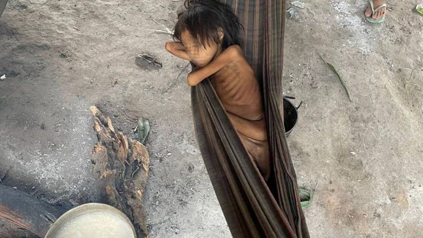 8 lat i 12 kilogramów. Dziecko, które stało się symbolem zaniedbania w Brazylii