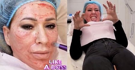 Sylwia Peretti funduje sobie WAMPIRZY LIFTING i rozprawia o hejcie: "Wylałam morze łez"