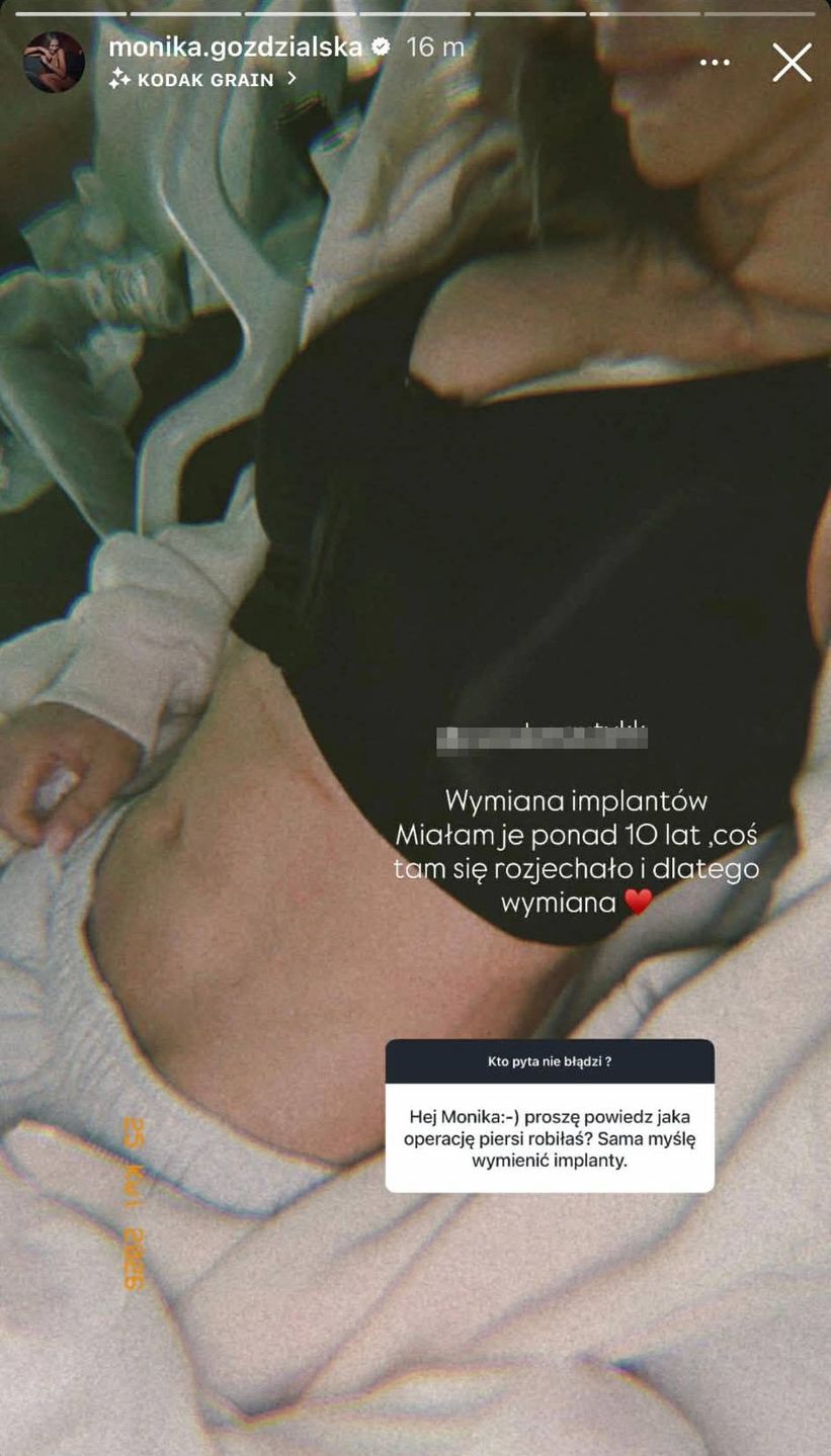 Monika Goździalska o operacji piersi 