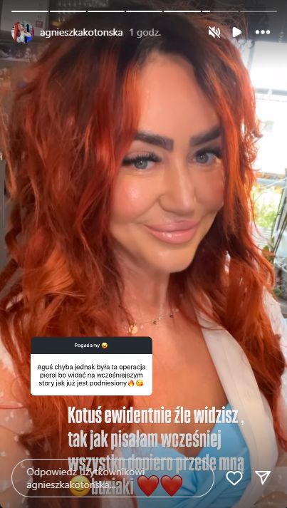 Agnieszka Kotońska rozprawia o operacji biustu
