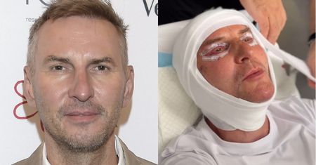 TYLKO NA PUDELKU: Krzysztof Gojdź zafundował sobie lifting za 150 tysięcy złotych! "Jestem z Hollywood. U nas liftingi są normą"