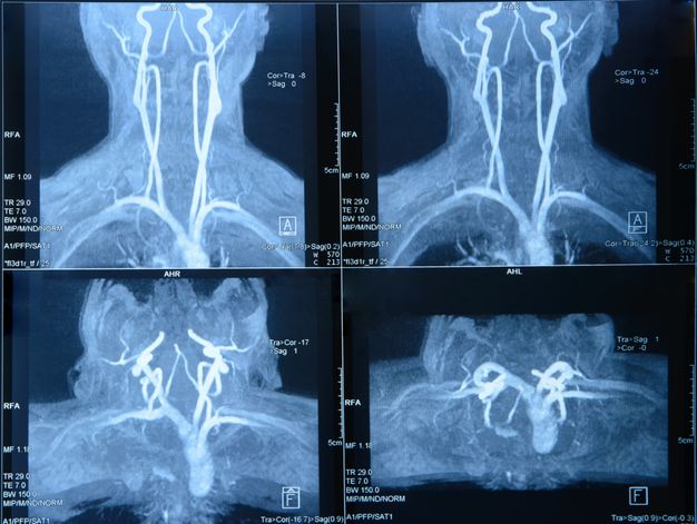 Rezonans magnetyczny szyi odbywa się w pracowni MRI