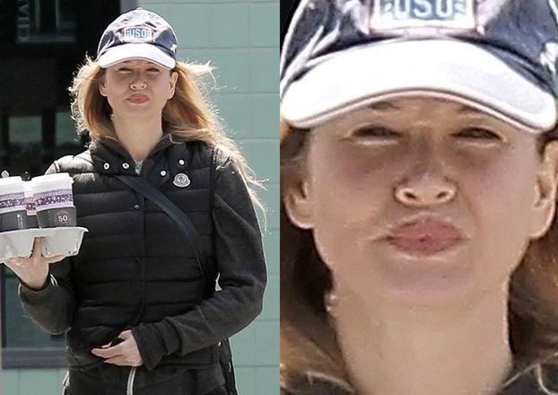 Renee Zellweger powiększyła usta!