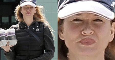 Renee Zellweger powiększyła usta!