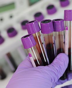 Epidemia szaleje na Madagaskarze. Gorsza niż koronawirus?