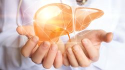 Włóknienie wątroby - przyczyny, diagnostyka, leczenie, dieta