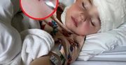 Odkryła "czarną kropkę" na ciele 3-latka. Jego stan zaczął się pogarszać