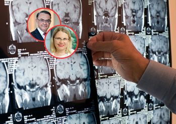 Jak odmłodzić mózg? Eksperci mówią, co zapewnia mu długowieczność