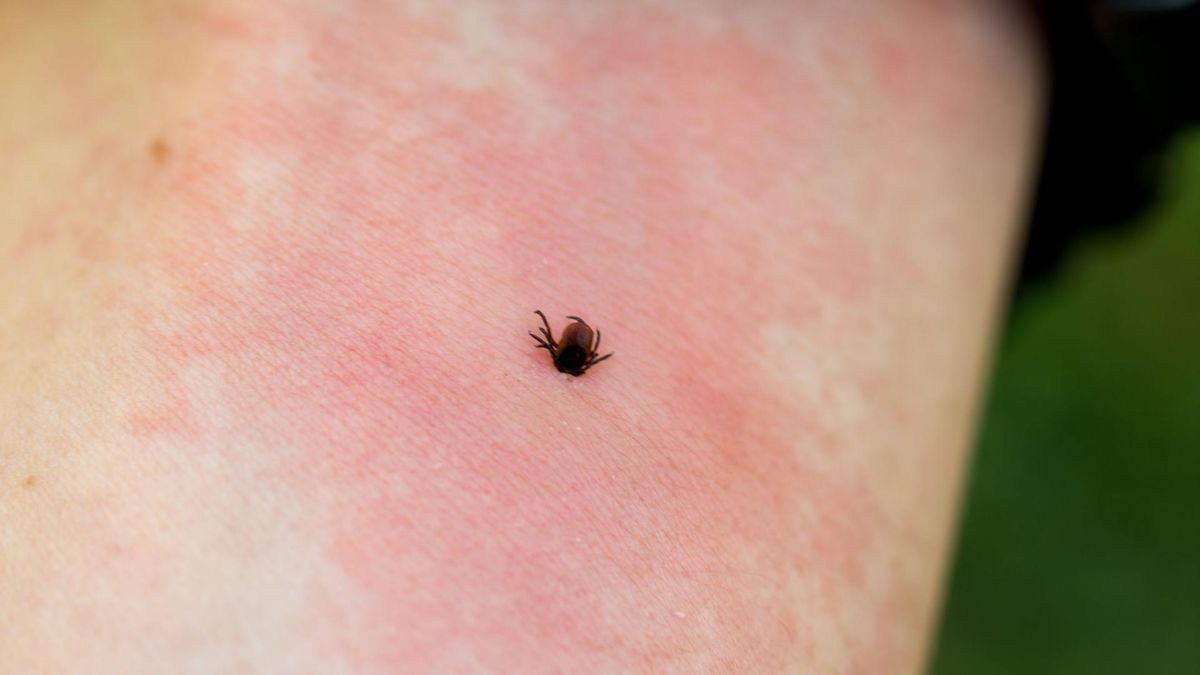 Najpopularniejsze mity na temat kleszczy
