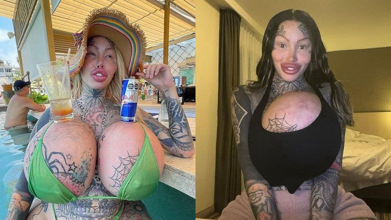 Te gwiazdy pożałowały operacji plastycznych