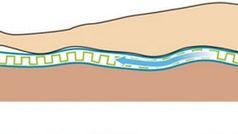 Klimatyzacja dla łóżka 1