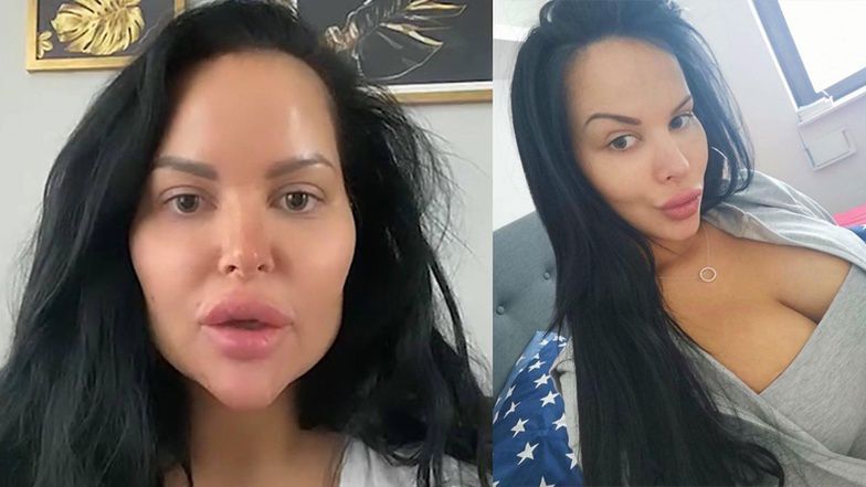 Esmeralda Godlewska opowiada o terapii i walce z depresją