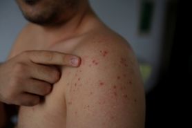 Polska utraciła odporność. Wzrasta ryzyko zapomnianej epidemii