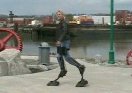Bioniczne zwierzęce nogi (wideo)