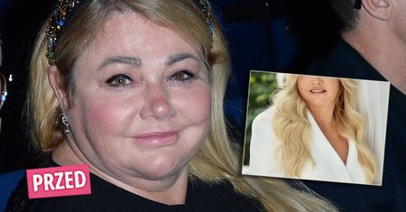 Wyrzuciła te potrawy z diety i dokonała cudów. Katarzyna Niezgoda zrzuciła aż 30 kilogramów