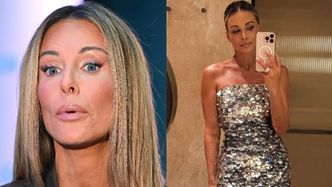 Małgorzata Rozenek wprost o kompleksach i poprawkach: "Ja nikogo nie okłamuję"