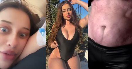 Fagata POWIĘKSZYŁA POŚLADKI... u "chirurga-partacza", którego broniła Justyna Gradek! (FOTO)
