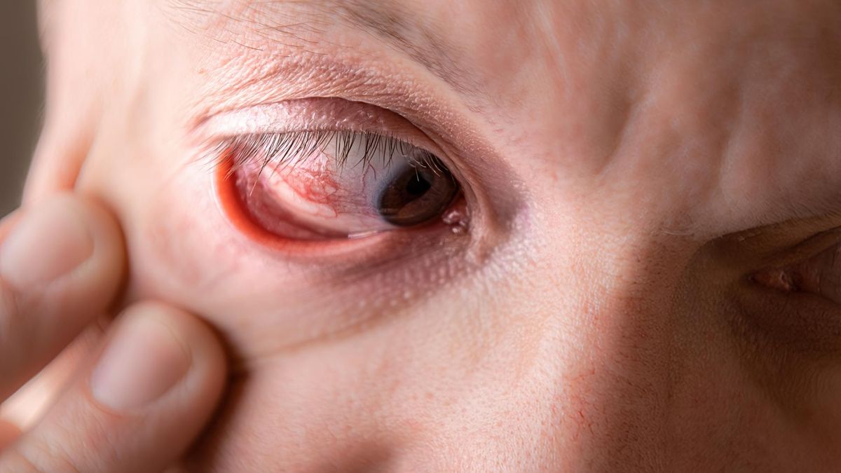 Na udar mogą wskazywać nagłe problemy ze wzrokiem