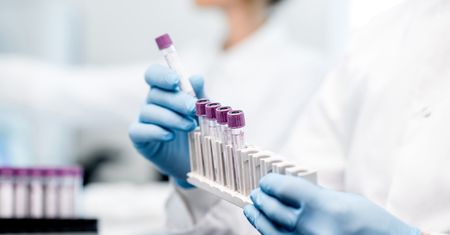 Cytometria przepływowa – jak wygląda badanie?